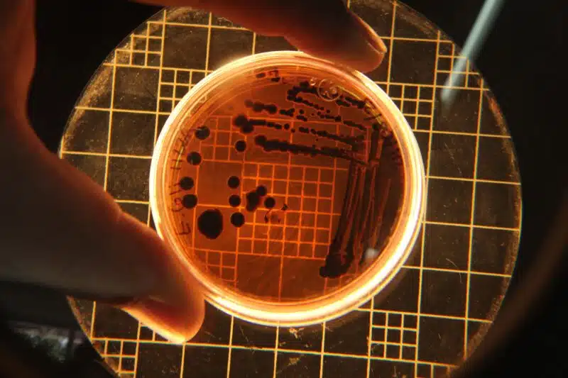 Impact du gluten sur le microbiote